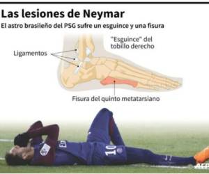 Neymar Jr será operado este fin de semana en Brasil, para prepararlo para el Mundial.