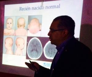 Representantes de la Secretaría de Salud, OPS y Hospital Escuela Universitario (HEU) se reunieron para discutir las medidas.