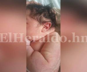 Un bebé con microcefalia nació este día en el Hospital (Foto: EL HERALDO Honduras / Noticias de Honduras)