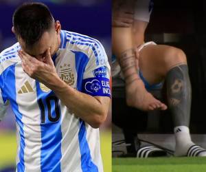 Leo Messi se lesionó con Argentina en la gran final ante Colombia por la Copa América 2024.