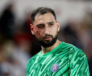 El PSG no ha entrado en detalles sobre cuánto tiempo estará Donnarumma inactivo tras la terrible lesión que sufrió ante el Mónaco.