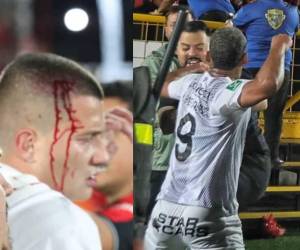 Sangre, golpes, capturados y agresiones hubo en el zafarrancho entre Herediano y la Liga Deportiva Alajuelense en el Estadio Alejandro Morera Soto.