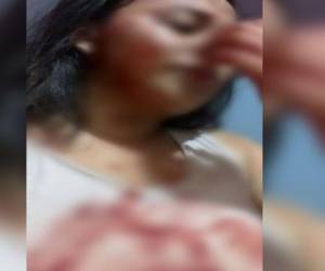 Jeymi León y su madre fueron golpeadas por su expareja.