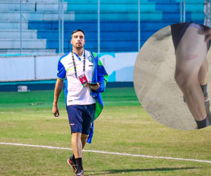 César Basigaluz, preparador físico de Olancho FC, fue agredido en el estadio Marcelo Tinoco.