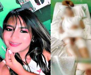 Desde su cama de hospital, Hazel Michel compartió los detalles escalofriantes de las brutales golpizas que sufrió a manos de su exnovio, Fabricio Jared Matute, las cuales eran un presagio de lo que hoy sufre la joven ya que fue víctima de ataque cuando se transportaba con un amigo en una motocicleta en el sector de Chamelecón, el cual dejó gravemente heridos a ambos. Hoy la joven cuenta su verdad...