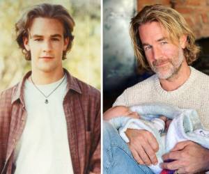 El icónico protagonista de Dawson’s Creek ha revelado su batalla contra el cáncer colorrectal.