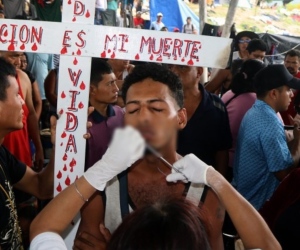 Entre los migrantes había hondureños y venezolanos, quienes decidieron coser sus labios en forma de protesta.