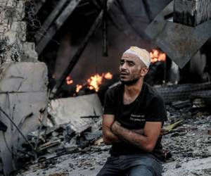 Un hombre herido se sienta frente a un edificio en llamas después de un ataque israelí en la ciudad de Gaza.