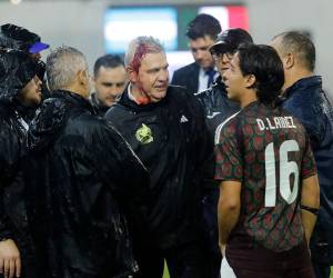 Así salió el entrenador tras la agresión en el estadio Morazán de San Pedro Sula.