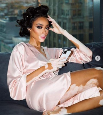 FOTOS: Winnie Harlow, la modelo que sería la nueva novia de Maluma