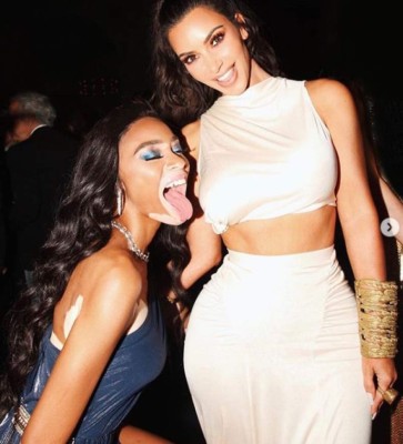 FOTOS: Winnie Harlow, la modelo que sería la nueva novia de Maluma