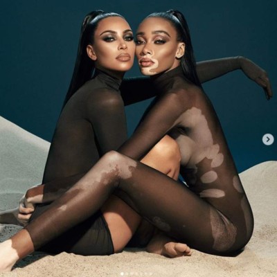 FOTOS: Winnie Harlow, la modelo que sería la nueva novia de Maluma