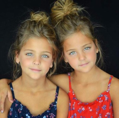 FOTOS: Leah Rose y Ava Marie, las gemelas más bellas del mundo, son sensación en Instagram