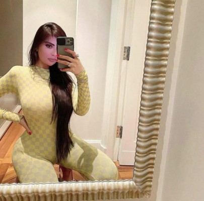 Influencer se realiza cientos de cirugías para parecerse a Kim Kardashian y ahora se arrepiente