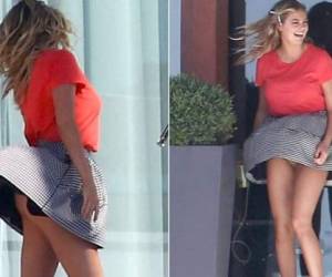 El incidente tuvo lugar durante una sesión de fotos en la casa de Kate Upton en Miami.