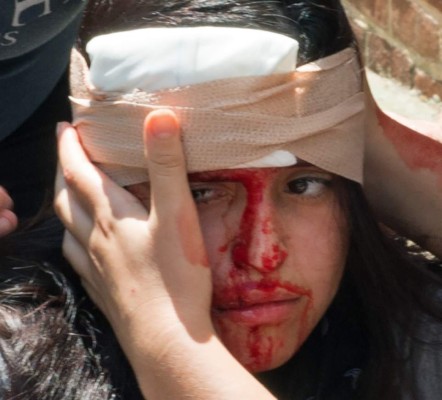 Las fotos más impactantes que dejó el ataque racista en Charlottesville, Virginia, Estados Unidos