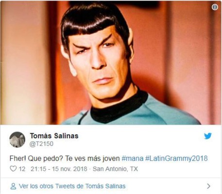 El nuevo rostro de Fher de Maná desata memes en las redes sociales