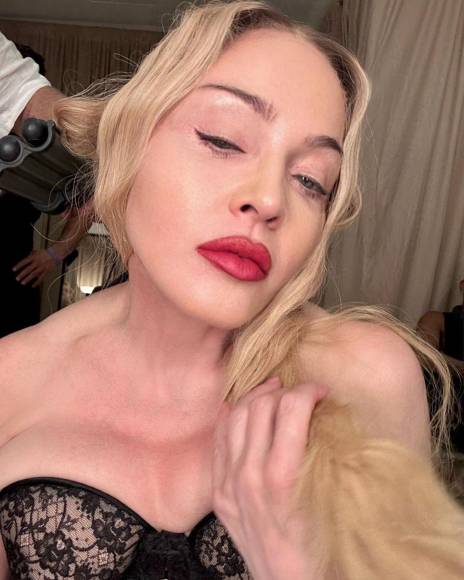 Madonna llega a los 65 años lista para empezar su gira tras infección bacteriana