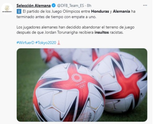 Así reacciona el mundo por los insultos racistas en el partido Honduras-Alemania