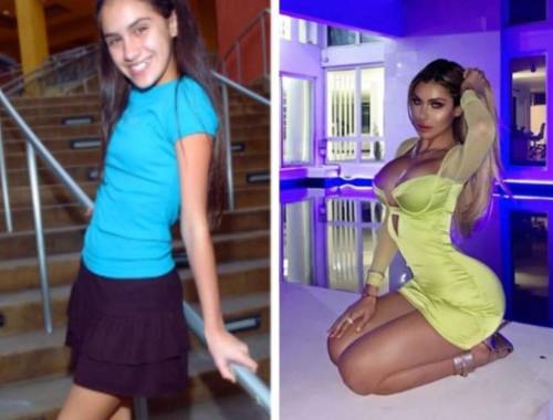 FOTOS: 10 famosas que transformaron sus cuerpos y rostros con cirugías