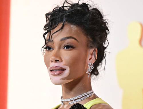 Winnie Harlow impacta con su look en la alfombra champagne de los Oscar