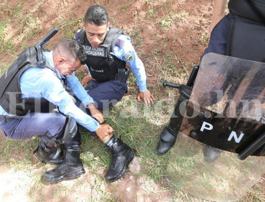 Fotos: Así terminaron quemados cuatro policías tras violento enfrentamiento con miembros del MEU