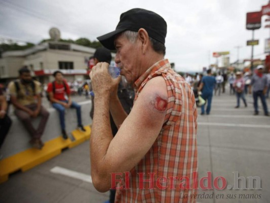 FOTOS: Segundo día de paro nacional deja enfrentamientos entre manifestantes y policías