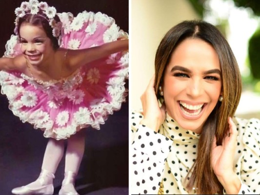 Biby Gaytán: el antes y después de la exintegrante de Timbiriche