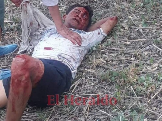 FOTOS: Escena del fatal accidente que dejó cuatro muertos y tres heridos en La Moramulca