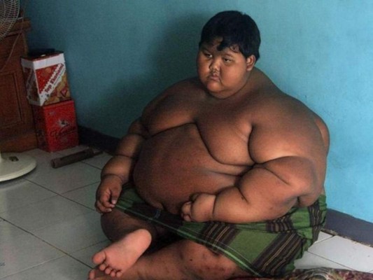 FOTOS: El cambio físico del niño más obeso del mundo que desea ser futbolista