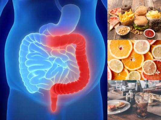 Los alimentos que no debes comer cuando tienes colitis (FOTOS)