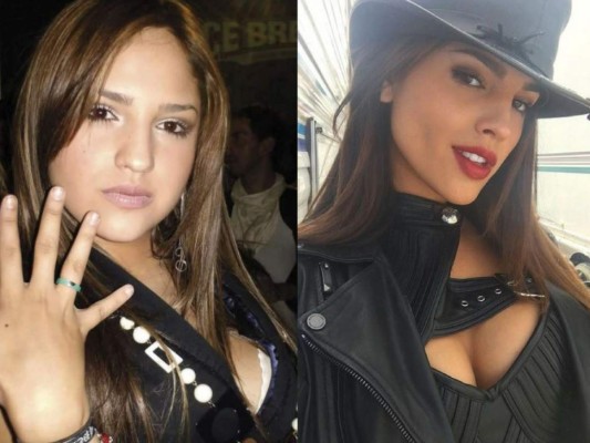 ¿Efecto de las cirugías? El asombroso antes y después de Eiza González