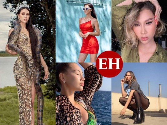 Modelo peruana Tiffany Yoko sufre fatal accidente que desfiguró su rostro (FOTOS)