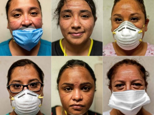 Rostros heridos y enrojecidos: las marcas del personal sanitario en México (FOTOS)  