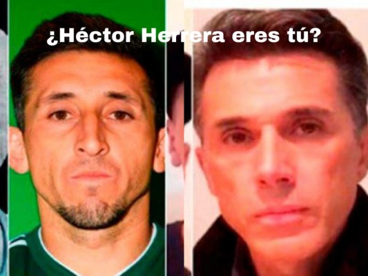 Despiadada ola de memes contra Héctor Herrera tras su cirugía en nariz y orejas