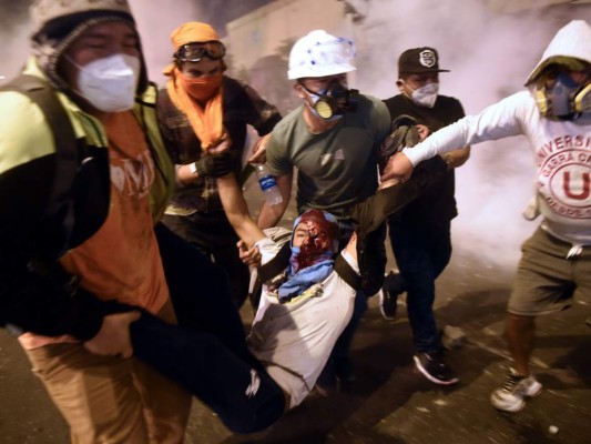 FOTOS: Renuncia de Manuel Merino, presidente Perú, desata celebración en las calles   