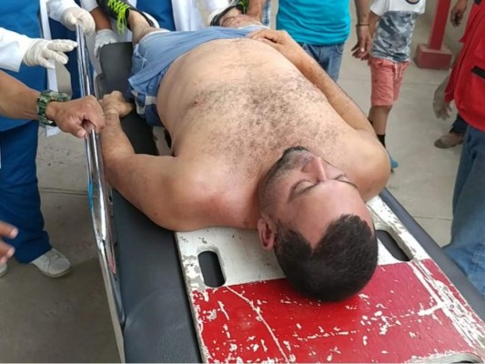 FOTOS: El dramático rescate de las personas que inhalaron monóxico de carbono dentro de un pozo en Copán