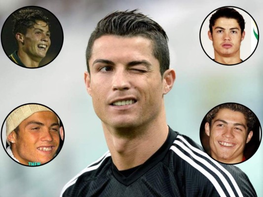 FOTOS: Revelan las cinco cirugías que se ha realizado Cristiano Ronaldo