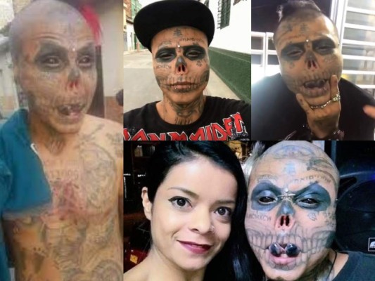 Así es Kalaca Skull, el colombiano que se mutiló las orejas y la nariz para parecer calavera