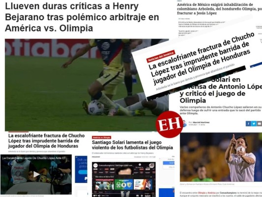 Juego sucio y violento: Esto dice la prensa internacional sobre el juego de Olimpia ante el América