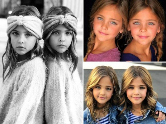 FOTOS: Leah Rose y Ava Marie, las gemelas más bellas del mundo, son sensación en Instagram