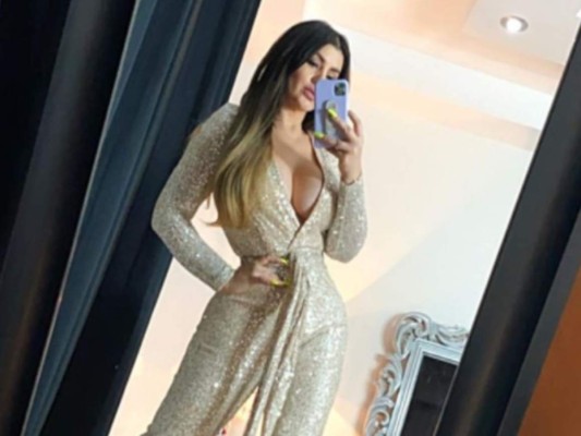 Las cirugías de Mariana González, la Kim Kardashian mexicana (FOTOS)