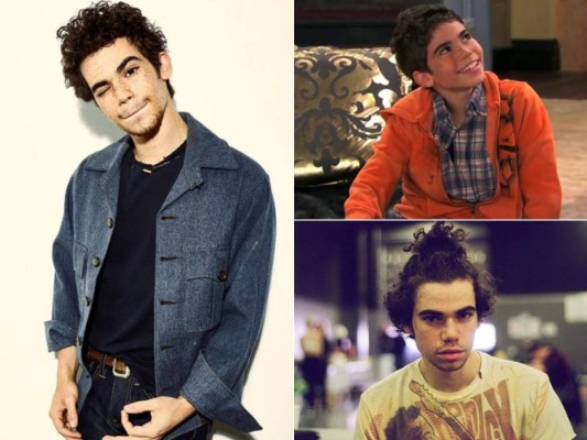 Carismático, talentoso y extrovertido: Así era Cameron Boyce, el actor de Jessie que murió cuando dormía