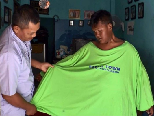 FOTOS: El cambio físico del niño más obeso del mundo que desea ser futbolista