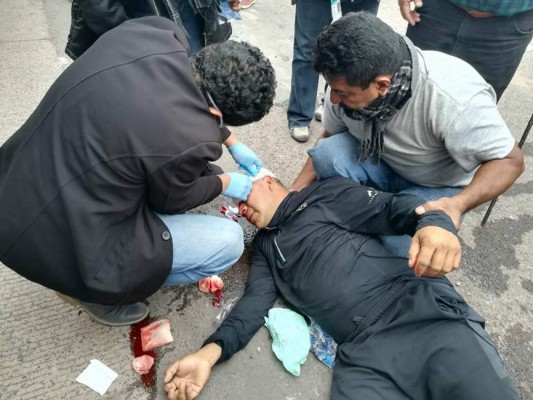 Violencia y represión en manifestación de simpatizantes de Alianza de Oposición