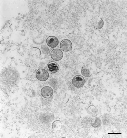 ¿Cómo se transmite la viruela del mono, la enfermedad que no tiene tratamiento?