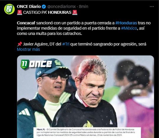 Lo que dicen los medios mexicanos tras castigo a Honduras por agresión a Javier Aguirre