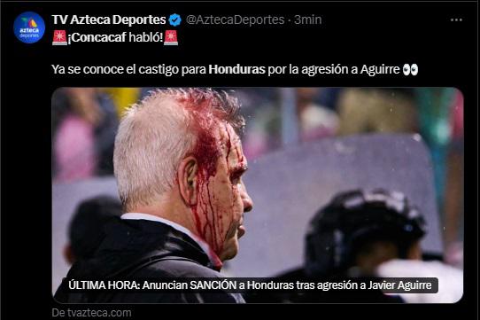 Lo que dicen los medios mexicanos tras castigo a Honduras por agresión a Javier Aguirre