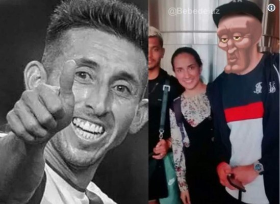 Despiadada ola de memes contra Héctor Herrera tras su cirugía en nariz y orejas