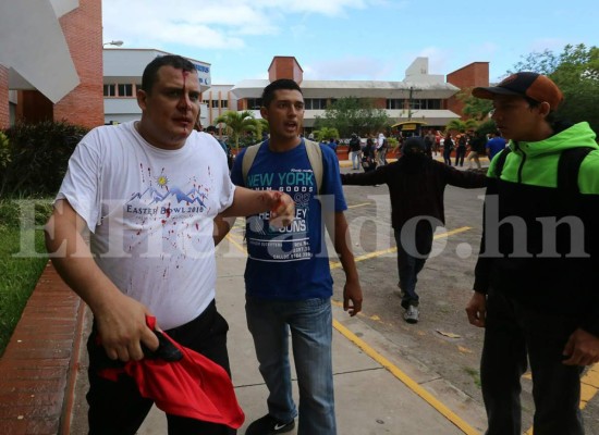 Las diez fotos más impactantes de la batalla entre universitarios y seguridad privada en la UNAH